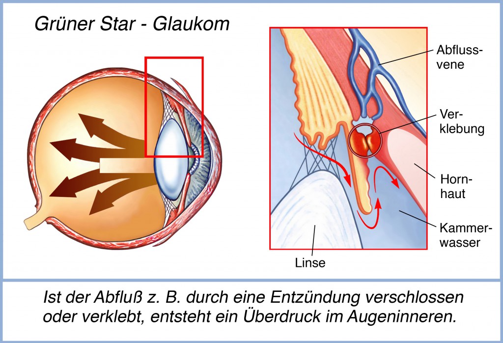 (Bild: Henrie/fotolia.com)