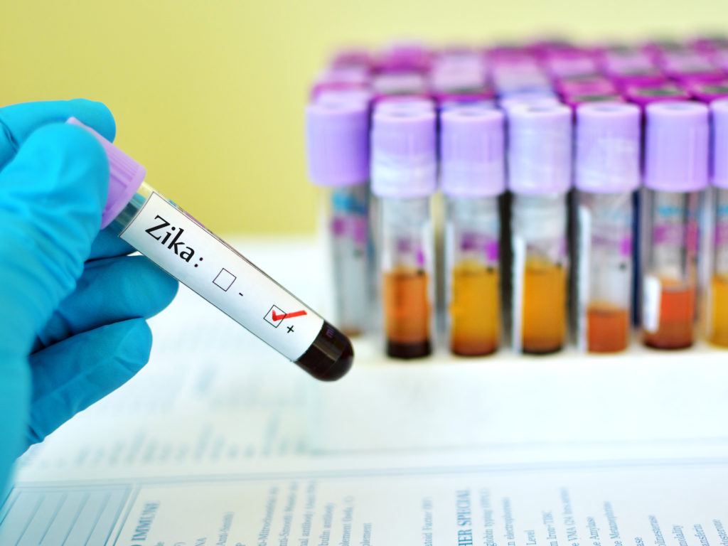 Auch in Berlin wurde nun der erste Zika-Fall bestätigt. (Bild: jarun011/fotolia.com)