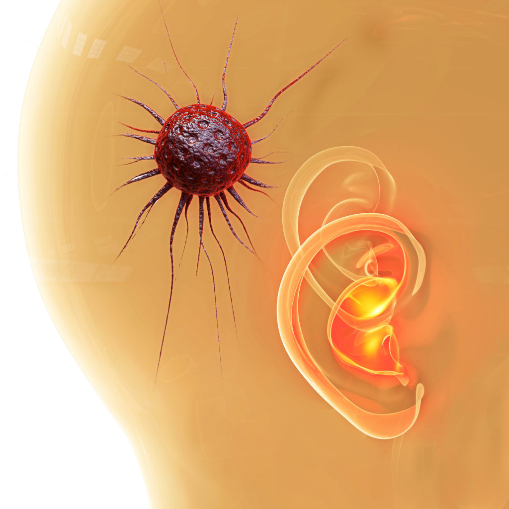 Vielen Betroffenen kann bei einem Hirntumor heute geholfen werden. (Bild: fotoliaxrender/fotolia.com)