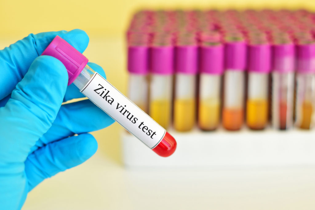 Seit Monaten breitet sich das gefährliche Zika-Virus in Ländern Lateinamerikas immer weiter aus. Der Erreger kann bei Neugeborenen offenbar Schädelfehlbildungen verursachen. In Brasilien sind bereits 57 Babys daran gestorben. (Bild: jarun011/fotolia.com)