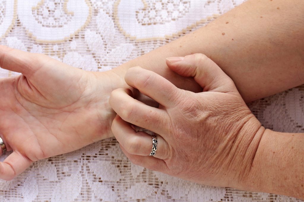 Zwar meinen manche Menschen, die Krätze sei ausgerottet, doch das ist sie nicht. Im Gegenteil: In manchen Regionen Deutschlands ist die ansteckende Hautkrankheit derzeit wieder auf dem Vormarsch. (Bild: Astrid Gast/fotolia.com)