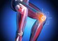 Schmerzen unterhalb der Kniescheibe sind häufig auf Beeinträchtigungen des Kniegelenks zurückzuführen. (Bild: psdesign1/fotolia.com)