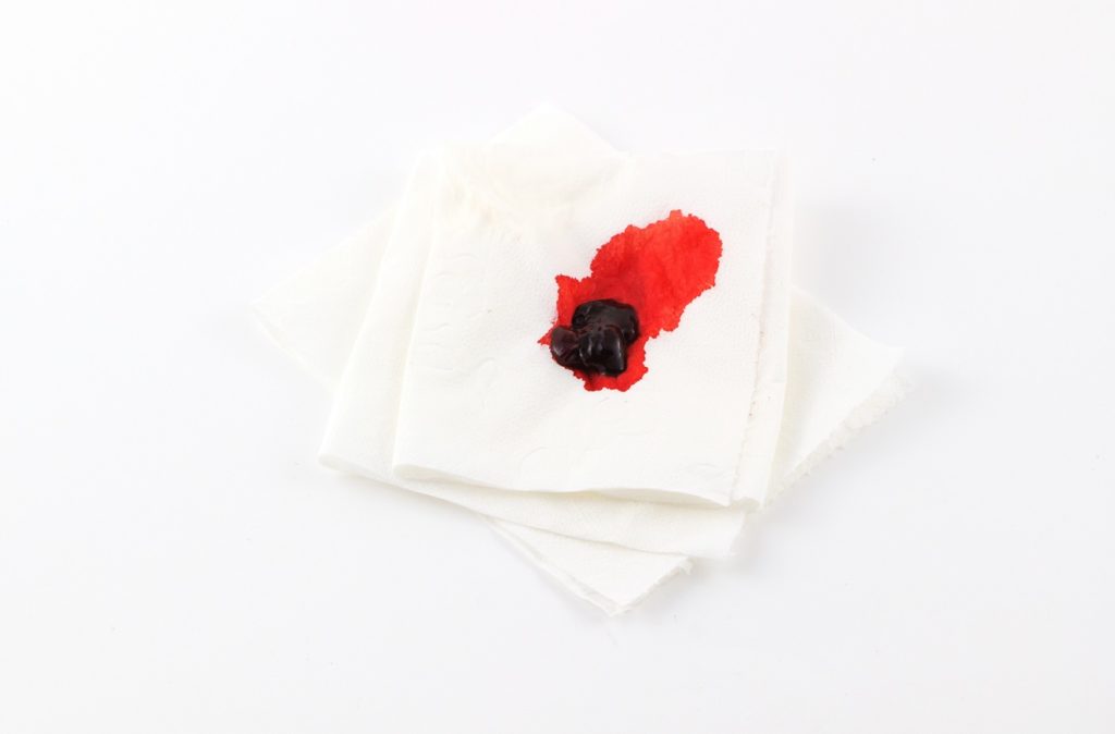 Blut im Stuhl ist leicht zu erkennen, wenn es sich in Form von hellroten Flecken auf dem Toilettenpapier zeigt. (Bild: parntawan1987/fotolia.com) 