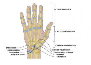 Nekrosen können theoretisch an sämtlichen Hand- und Fingerknochen auftreten. Eine Spezielle Form ist die aseptische Kahnbeinnekrose, welche auch als Morbus Preiser bezeichnet wird. (Bild: elvira gerecht/fotolia.com)