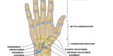 Nekrosen können theoretisch an sämtlichen Hand- und Fingerknochen auftreten. Eine Spezielle Form ist die aseptische Kahnbeinnekrose, welche auch als Morbus Preiser bezeichnet wird. (Bild: elvira gerecht/fotolia.com)