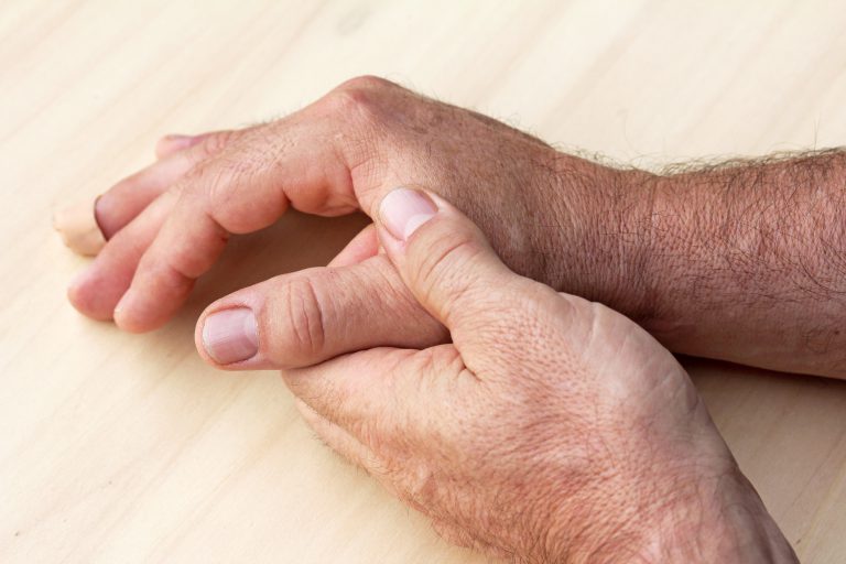 Rhizarthrose – Daumenarthrose – Heilpraxis