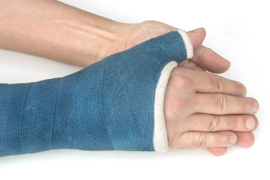 Meist ist im Rahmen der Behandlung von Morbus Preiser einer Ruhigstellung mit einem Gipsverband vorgesehen. (Bild: Fenton/fotolia.com)