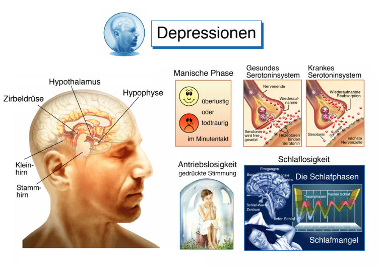 Depression – Symptome, Ursachen und Therapie – Heilpraxis