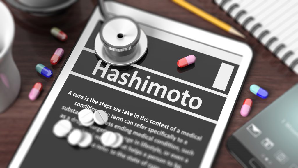 Ist die Diagnose gesichert, wird die Hashimoto-Thyreoiditis in der Regel mit der Verabreichung von Schilddrüsenhormonen therapiert. (Bild: viperagp/fotolia.com)