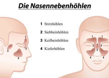 Es wird zwischen vier verschiedenen Nasennebenhöhlen unterschieden, die offen mit dem mittleren Nasengang verbunden sind. (Bild: Peter Hermes Furian/fotolia.com)