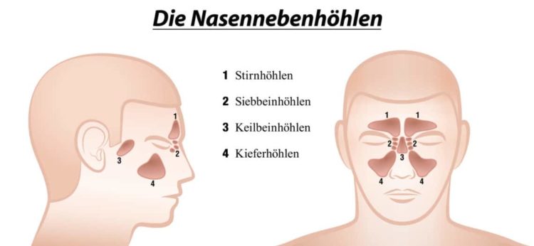Ein Auge Tränt Und Ein Nasenloch Läuft Nasennebenhöhlenentzündung – Symptome, Ursachen und wirksame Hausmittel