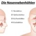 Es wird zwischen vier verschiedenen Nasennebenhöhlen unterschieden, die offen mit dem mittleren Nasengang verbunden sind. (Bild: Peter Hermes Furian/fotolia.com)