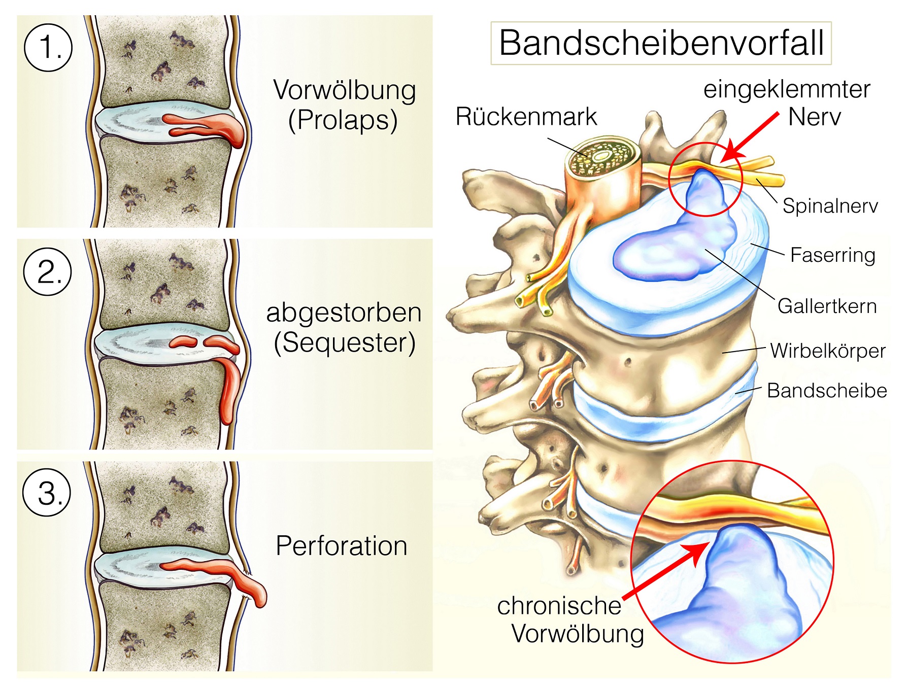 Die fünf wichtigsten Fragen und Antworten zu Rückenschmerzen Naturheilkunde Die fünf wichtigsten Fragen und Antworten zu Rückenschmerzen Naturheilkunde