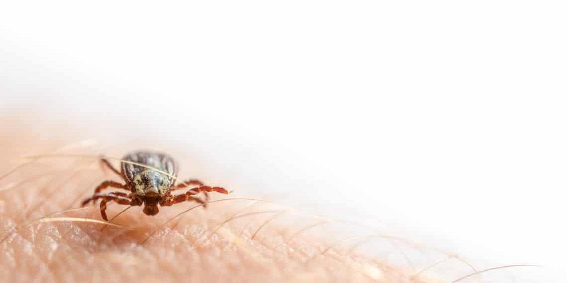 Acrodermatitis Heilpraxis