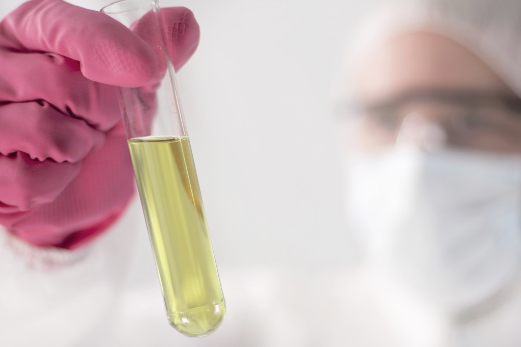 Off Focus Labrant looking at Urinal Sample in Tube