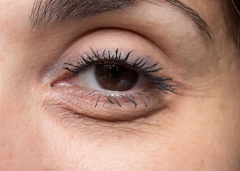 Schwere Lider und trübe Augen sind häufig ein Zeichen für Müdigkeit oder Überanstrengung.  (Bild: Alessandro Grandini/fotolia.com)