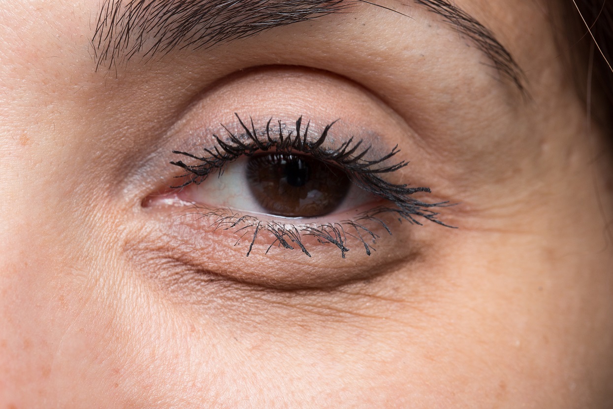 Trube Augen Ursachen Erkrankungen Und Behandlung Heilpraxis