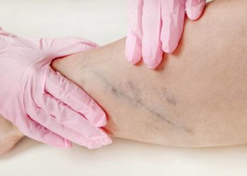 Ein Arzt untersucht den Unterschenkel eines Patients.
