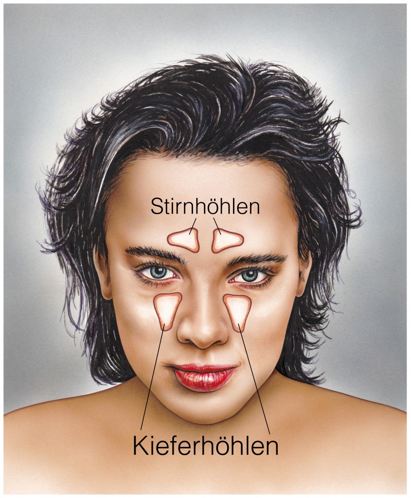 Stirn schmerzen nebenhöhlen Nebenhöhlenentzündung ist