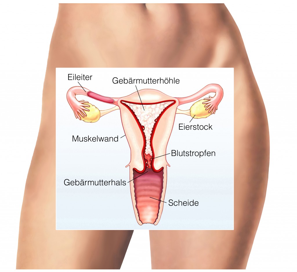 Menstruation übelriechender ausfluss nach SCHWARZE ENTLADUNG: