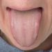 Eine gesunde Zunge ist durch eine blass roten Farbe und einen dünnen weißen Belag gekennzeichnet. (Bild: fpic/fotolia.com)