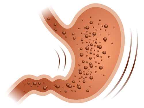 Aufgeblahter Bauch Ursachen Und Behandlung Heilpraxis