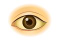 Eine Gelbfärbung des Auges deutet meist auf eine Erkrankung von Leber oder Galle hin. (Bild: logo3in1/fotolia.com)