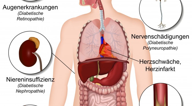 Folgeerkrankungen bei Diabetes verhindern