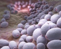 Eine Anreicherung des Darmpilzes Candida albicans