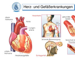 Herzkrankheiten