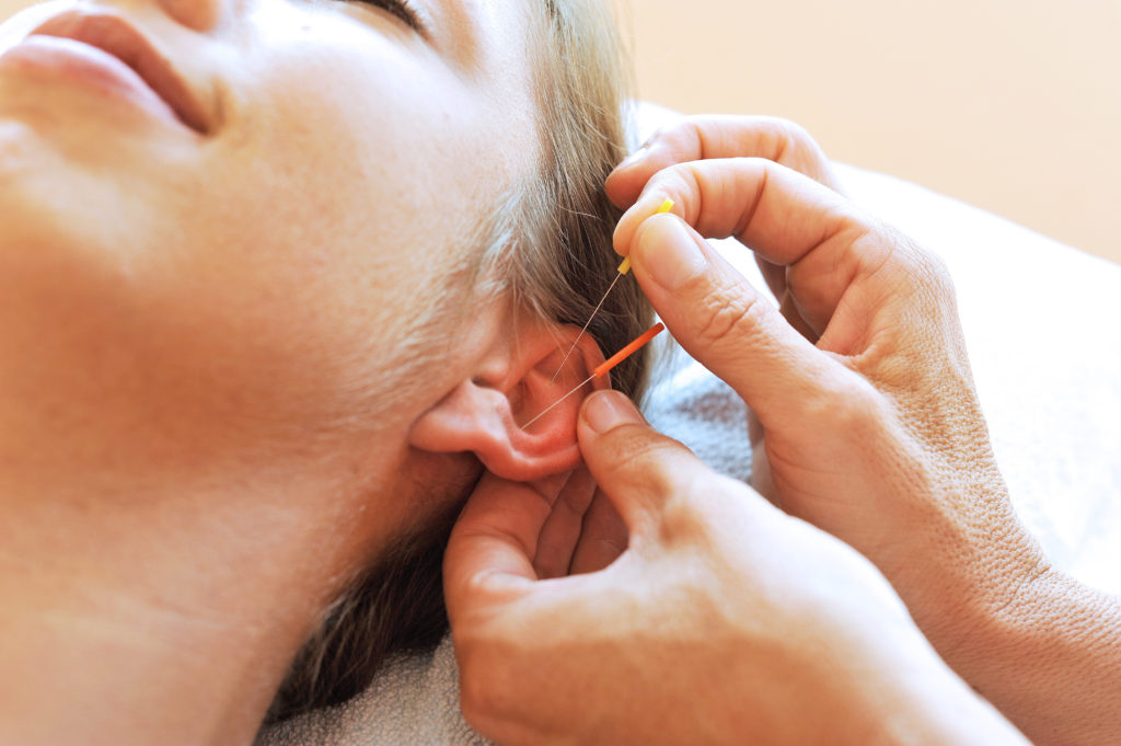 Die Ohrakupunktur ist eine besondere, häufig angewendete Form der traditionellen chinesischen Heilmethode. (Bild: photophonie/fotolia.com)