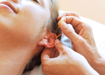 Die Ohrakupunktur ist eine besondere, häufig angewendete Form der traditionellen chinesischen Heilmethode. (Bild: photophonie/fotolia.com)