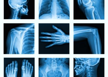 Collage of many X-rays in very good quality.