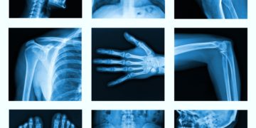 Collage of many X-rays in very good quality.