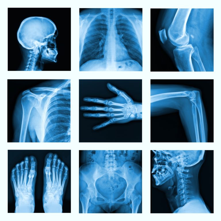 Degenerative Erkrankungen Heilpraxis