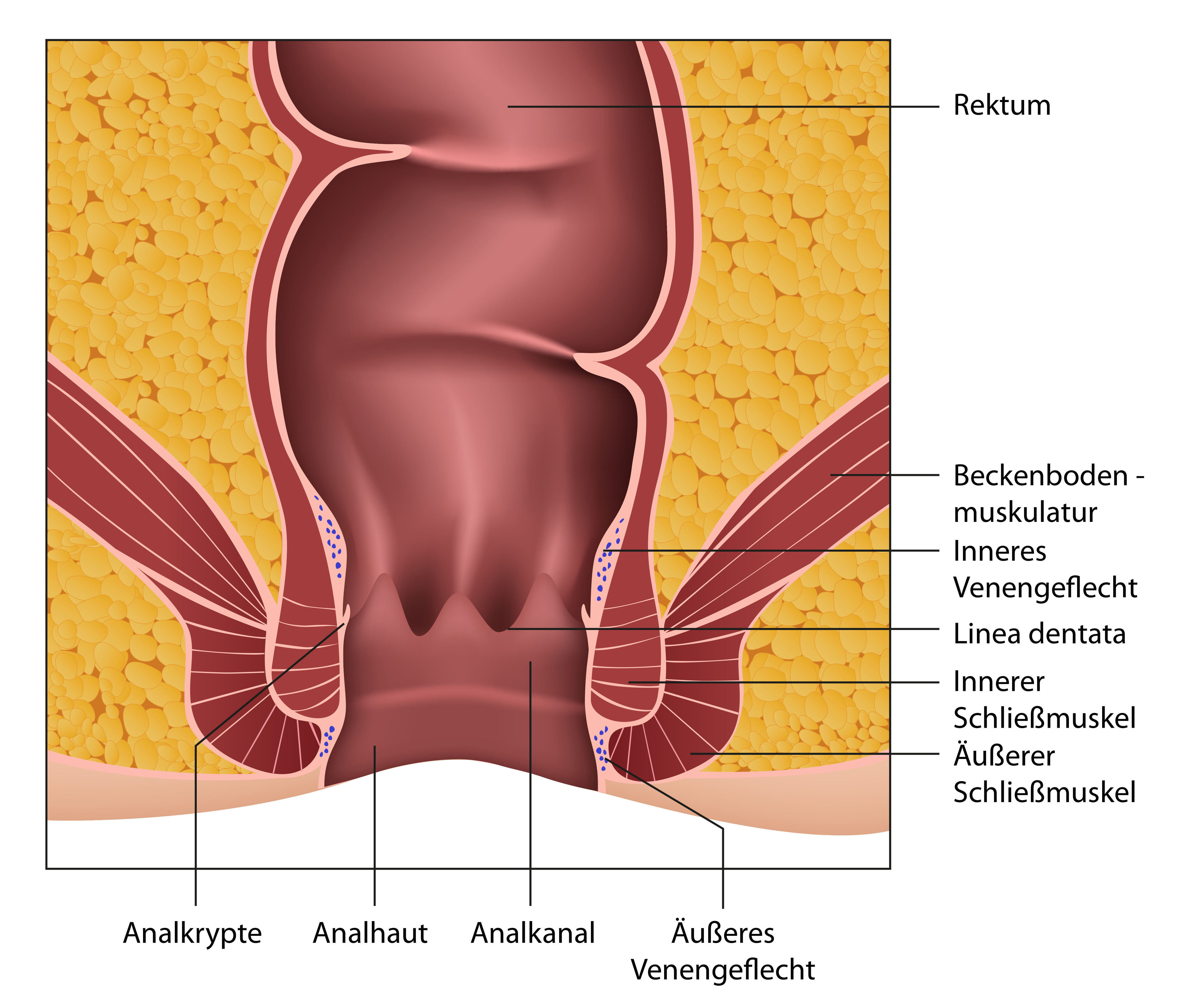 Anus: Beschwerden oder Schmerzen am oder im After haben unterschiedliche Ursachen.