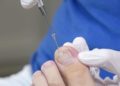 Nagelspange, Orthonyxiespange bei einem eingewachsenen Zehennagel. (Bild: Maria/fotolia.com)