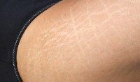 Junge frauen suchen ältere männer rockford illinois