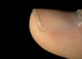 Brüchige Fingernägel können unangenehm sein und unter Umständen auch eine krankheitsbedingte Ursache haben. (Bild: iCreations.de/fotolia.com)