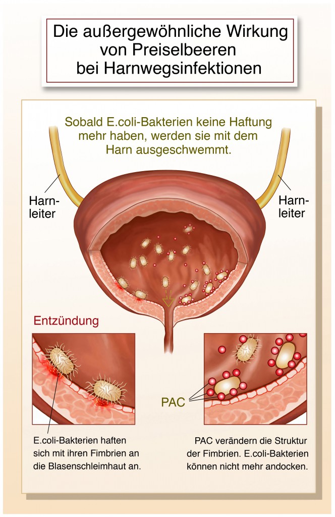 Rot juckt eichel und Rote Eichel