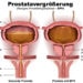 Eine vergrößerte Prostata erhöht das Risiko für eine Infektion in den Harnwegen. (Bild: bilderzwerg/fotolia.com)