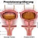 Eine vergrößerte Prostata erhöht das Risiko für eine Infektion in den Harnwegen. (Bild: bilderzwerg/fotolia.com)