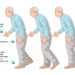 Die neuesten Entwicklungen der Parkinson-Diagnostik und -Behandlung werden auf dem Jahreskongress der DGN in Leipzig vorgestellt. (Bild: rob3000/fotolia.com)