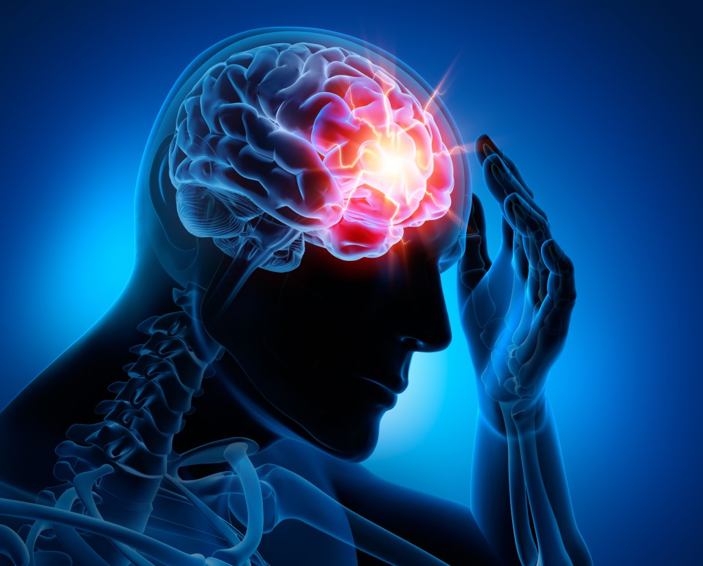 Eine neue Therapie könnte das Leiden von Migräne-Patienten mindern. (Bild: psdesign1/fotolia)