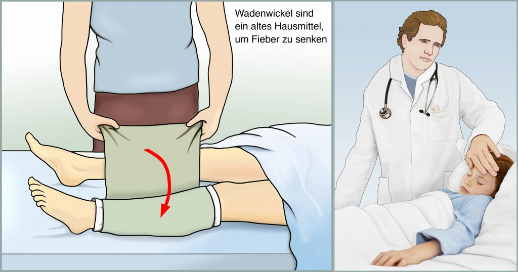 Erste Hilfe bei hohem Fieber. Kalte Wadenwickel entziehen dem Koerper Waerme. Tuecher straff um die Wade wickeln. Nach etwa 15 Minuten sollte die Koerpertemperatur um mindestens ein halbes Grad gesunken sein. [Abdruck nur mit Honorar, Namensnennung und Belegexemplar Henning Riediger Tannenhof 117c 22397 Hamburg Tel. 040/6080742 E-Mail: henning.riediger@t-online.de Steuer-Nr. 50/198/00549 USt.-IdNr. DE 118420134 Bankverbindung: Hamburger Sparkasse BLZ 200 505 50 Konto-Nr. 1299/475663 IBAN DE 27 2005 0550 1299 475663 BIC HASPDEHH]