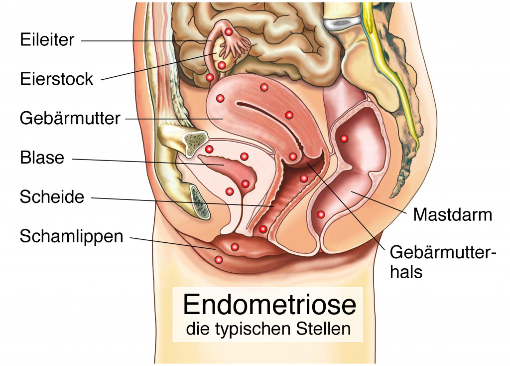 Schmerzen bei der Regel oder während des Eisprungs.