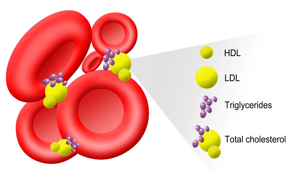 HDL Cholesterin ist nicht immer das Gleiche. Es kommt auf die Qualität an. Bild: Sophia Winters/fotolia