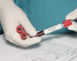 HIV-Test