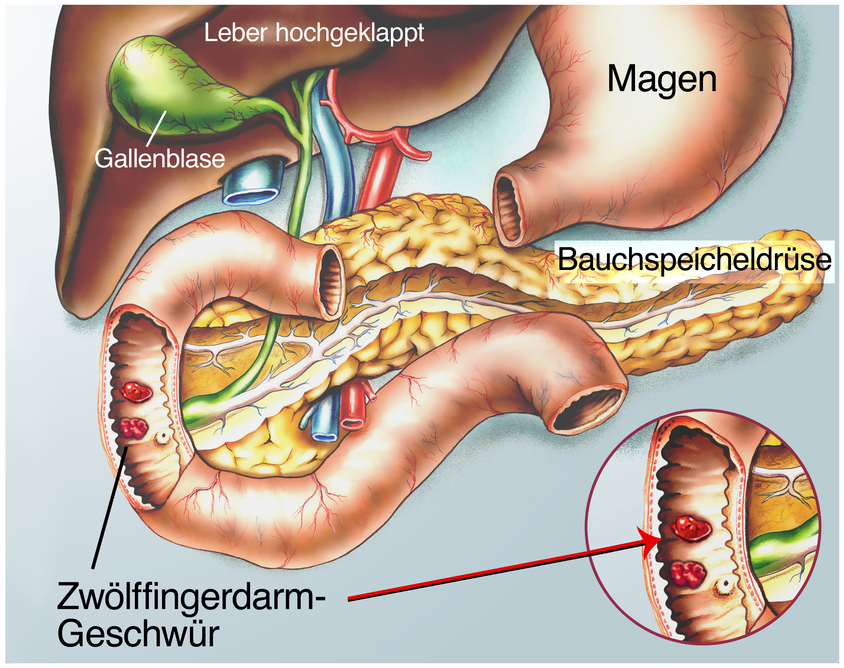 Stechende Schmerzen Oberbauch Links.