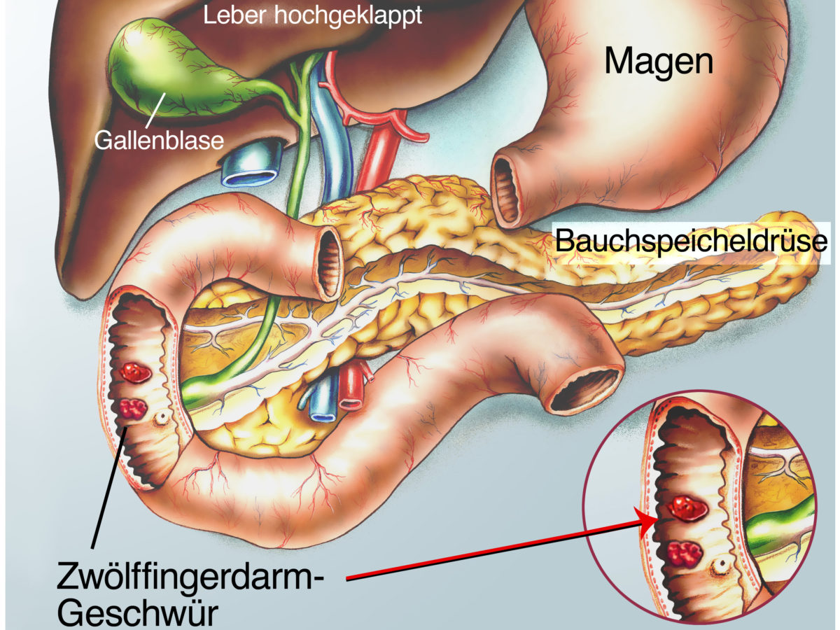 Leichtes stechen in der rechten brust